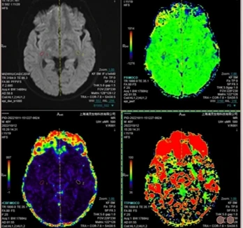 カニクイザルの生体内分布研究|Prisys Biotech 前臨床 CRO