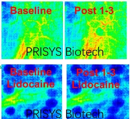 NHPの痛みモデル：Prisys Biotechでの鎮痛薬の促進薬の発達の加速
